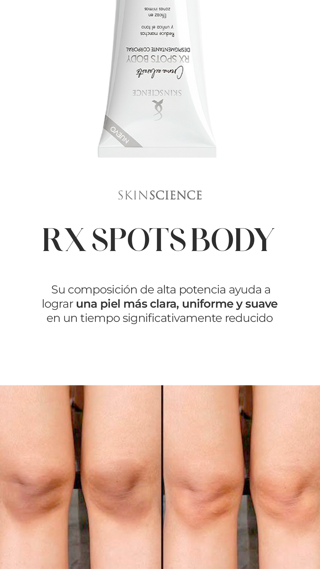 SPOTS BODY